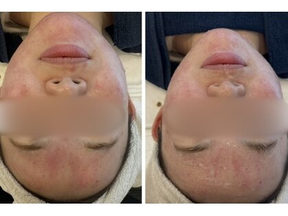 サロンドール(Salon doll)の写真