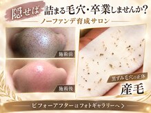 デアマリス