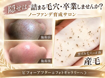 デアマリスの写真