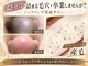 デアマリスの写真