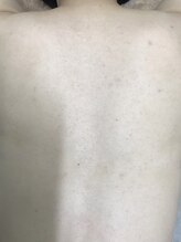 ナノハナ/鹿沼市本格全身脱毛ナノハナ