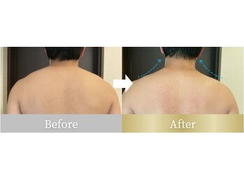 ウノジェンネ UNO DJENNE/40代★首肩の酷いコリがスッキリ