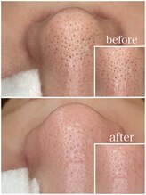 毛穴専科/毛穴洗浄+白玉ワックス メンズ◎