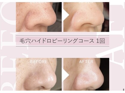 ビップフィール(vip feell)の写真