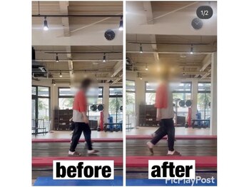 カワル整体 上通り院/【腰痛のせいで背中が丸まった】