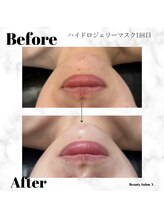 ワイドット(Y.)/透明感抜群