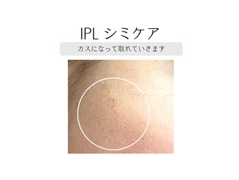 イチキュービー 仙台駅前東口店(19B)/IPL光フェイシャル