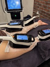 セルティビューティーサロン(CELTY)/裏もも＆ふくらはぎ