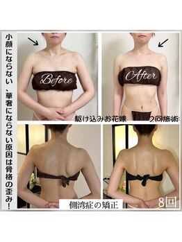 蒼(so)の写真/★実績3万人超！プロ講師による深い施術★首肩の不調や綺麗に痩せない原因は→歪み！根源を取り除く施術!