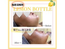 ナナイロヨジドン(nanairo麗姿堂)の雰囲気（脂肪分解モンボトル♪ナノニードル使用で奥まで浸透☆）