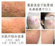 ビオラス(VIOLUS)