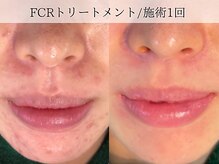 ミューズ バイ エス(MUSE BY S)/