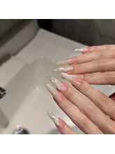 エスアイネイル(SI Nail)/