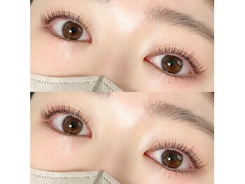 グリット(grit)/上下ラッシュリフト