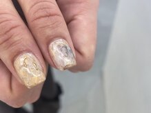 ブランクルネ(blanclune)/order design