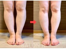 サロンアール(SALON R)/疲労むくみ軽減、サイズダウン