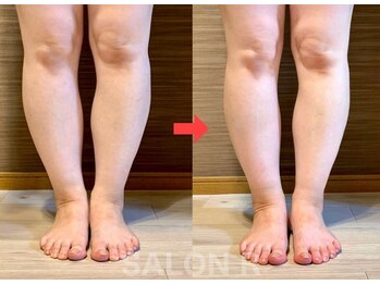 サロンアール(SALON R)/疲労むくみ軽減、サイズダウン