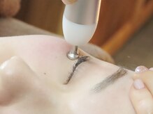 ビーエヌ エステティックアンドスパ(BN Esthetic&Spa)/RF高周波　まるでお肌のアイロン