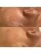 マボーテ 恵比寿(Ma-Beaute)の写真/何度も繰り返す肌悩みに！【リアボーテタラソトリートメント】結果重視の方も満足するほどお肌の変化を実感