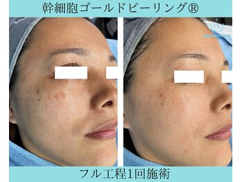 リメイククリニカルビューティー(Remake clinical beauty)/ぐっばい!