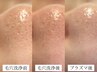 【毛穴引き締め】韓国式3D毛穴洗浄＋シルクde洗顔＋生プラセンタプラズマ導入