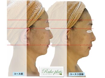 ルーエプラッツ 恵比寿(Ruhe plats)/年齢関係なく肌の変化を実感♪