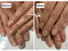 キュアネイル(Qa Nail)