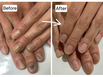 キュアネイル(Qa Nail)