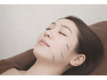 心 こころ/美容鍼