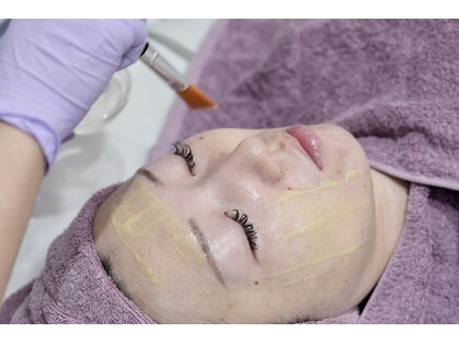ディンプル(Dimple)の写真