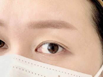 エルフ(elf)/薄眉改善（Ａｆｔｅｒ）