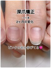 スマイルニコ(smile nico)/親指成長シリーズ