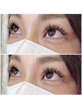 グリッターネイル(GLITTER NAILS)/アンドヘルシー