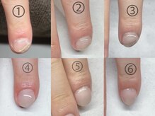 プチムトン 鶯谷店(petit mouton)/【深爪矯正コース】1