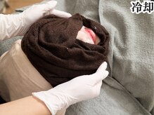 アデル 久留米(ADEL)/14、冷たいタオルで冷却