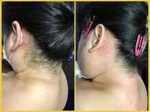 クラウン ジュエルズ(CROWN JEWELS)/【Wax脱毛】うなじ　サイド 4