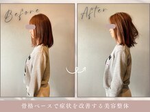 ほぐし屋 かすがい/猫背巻き肩矯正