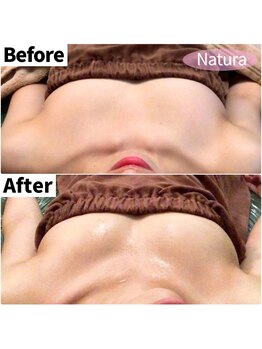 ナトゥーラ 心斎橋なんば本店(Natura)/ふっくらマシュマロバスト★難波