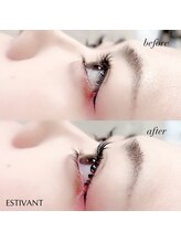 エスティバン 心斎橋(ESTIVANT)/横から見ても可愛い！！