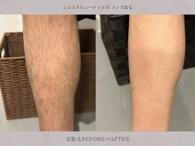 シエスタビューティラボ/【足脱毛】見られています…