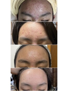 ダリア(Dahlia)/インセルダム