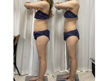 アンジュ(Ange)の雰囲気（凹凸脂肪に強い！引き締めのEMSつき/落ちなくなってきた脂肪に）