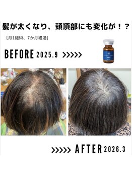 サンシー整体(SunCY整体)/６０代女性