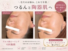 サロン ド ユイ(salon de yui)