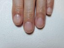 スペシャルネイルケア