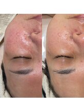 アンドラスター(andlaster)/【うる艶ケア☆マーメイドセル】