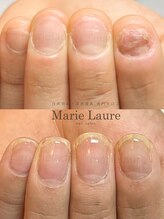 マリーロール 淀屋橋本店(Marie Laure)/自爪育成/深爪矯正/ネイルケア