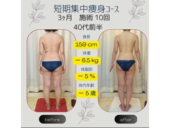 ティアエ(T-ae)/本気ヤセ【短期集中痩身コース】