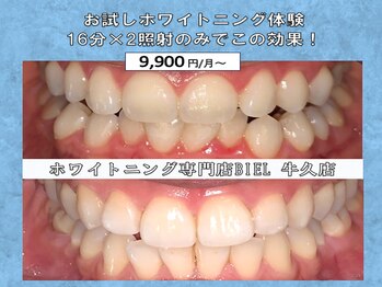 ビエル 牛久店(BIEL)/お試しホワイトニング