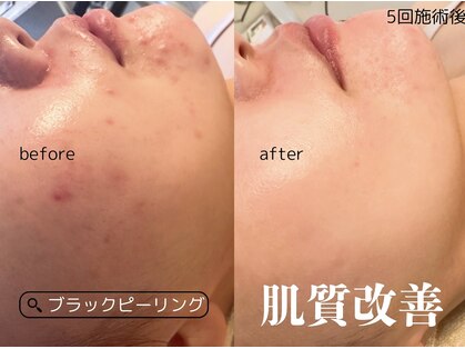 クオーレ 福津(cuore)の写真